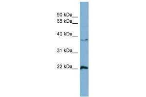 Ran antibody used at 1 ug/ml to detect target protein. (RAN 抗体  (Middle Region))