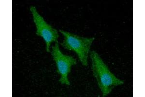 ICC/IF analysis of ACP1 in HeLa cells line, stained with DAPI (Blue) for nucleus staining and monoclonal anti-human ACP1 antibody (1:100) with goat anti-mouse IgG-Alexa fluor 488 conjugate (Green). (ACP1 抗体  (AA 1-158))