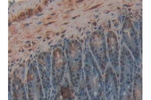 Detection of CPB2 in Mouse Intestine Tissue using Polyclonal Antibody to Carboxypeptidase B2 (CPB2) (CPB2 抗体  (AA 113-422))