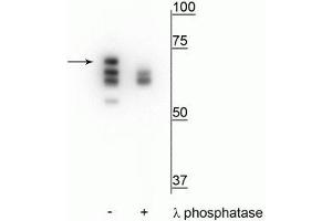 Western blot of T47D cell lysate treated with EGF (1 nM) for 60 minutes showing specific labeling of the ~70 kDa Hsp70 in the first lane (-). (HSP70 1A 抗体  (pThr153))