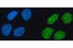IF analysis of hnRNP K/HNRNPK using anti-hnRNP K/HNRNPK antibody (ABIN7601650). (HNRNPK 抗体  (AA 40-463))
