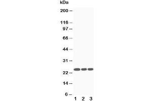 Western blot testing of SOCS3 antibody and Lane 1:  Jurkat;  2: CEM;  3: Raji cell lysate (SOCS3 抗体  (Middle Region))