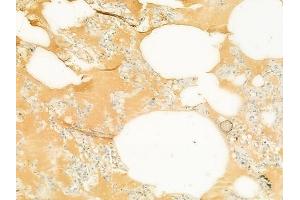ABIN6265573 and ABIN6272896 at 1/100 staining human normal lung tissue by IHC-P.