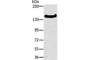 Western blot analysis of A172 cell, using FMNL1 Polyclonal Antibody at dilution of 1:350 (Formin-Like 1 抗体)
