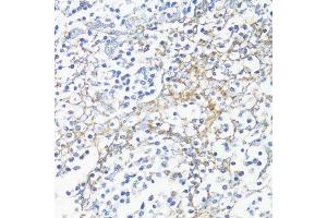 Immunohistochemistry of paraffin-embedded human tonsil using HSD17B10 antibody. (HSD17B10 抗体  (AA 1-261))