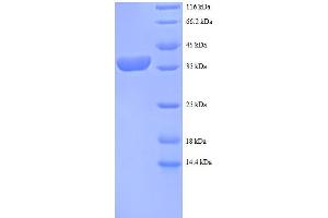 SDS-PAGE (SDS) image for Ribosomal Protein S12 (RPS12) (AA 1-132), (full length) protein (GST tag) (ABIN5712237) (RPS12 Protein (AA 1-132, full length) (GST tag))