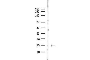 Western blot analysis of lysates from 293 cells(UV,30 min treatment), using DTYMK Antibody at 1/1000 dilution.