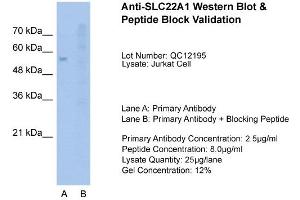 Western Blotting (WB) image for anti-Solute Carrier Family 22 (Organic Cation Transporter), Member 1 (SLC22A1) (N-Term) antibody (ABIN2776861)