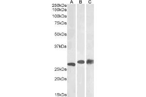 ABIN2564492 (0. (PGAM1 抗体  (C-Term))