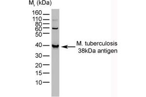 Image no. 1 for anti-Mycobacterium Tuberculosis, 38kDa antibody (ABIN304017) (Mycobacterium Tuberculosis, 38kDa 抗体)