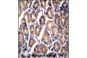 Immunohistochemistry (Paraffin-embedded Sections) (IHC (p)) image for anti-Retinoic Acid Receptor Responder (Tazarotene Induced) 1 (RARRES1) (AA 134-163), (C-Term) antibody (ABIN657062)