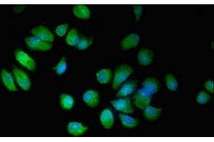 Immunofluorescent analysis of MCF-7 cells using ABIN7151962 at dilution of 1:100 and Alexa Fluor 488-congugated AffiniPure Goat Anti-Rabbit IgG(H+L) (EPN3 抗体  (AA 25-208))
