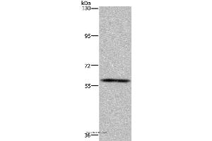 Western blot analysis of Human fetal brain tissue, using FTO Polyclonal Antibody at dilution of 1:650 (FTO 抗体)