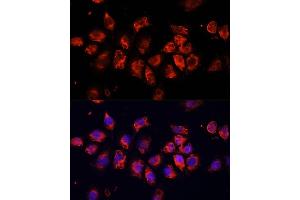 Immunofluorescence analysis of HeLa cells using SMO Polyclonal Antibody (ABIN6130715, ABIN6148140, ABIN6148141 and ABIN6220185) at dilution of 1:100 (40x lens). (SMO 抗体  (AA 554-787))