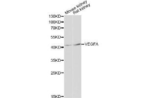Western blot analysis of extracts of various cell lines, using VEGFA antibody (ABIN5999168) at 1:3000 dilution. (VEGF 抗体)