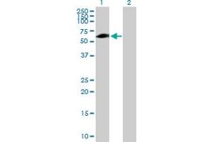 Western Blot analysis of EVC expression in transfected 293T cell line by EVC MaxPab polyclonal antibody. (EVC 抗体  (AA 1-535))