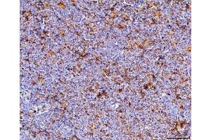 IHC analysis of Cd70 using anti-Cd70 antibody (ABIN7601463). (CD70 抗体  (AA 36-191))