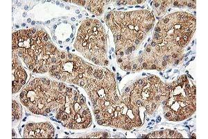 Immunohistochemical staining of paraffin-embedded Human Kidney tissue using anti-ALDOB mouse monoclonal antibody. (ALDOB 抗体)