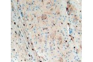 IHC-P analysis of Mouse Brain Tissue, with DAB staining. (S100B 抗体  (AA 1-92))