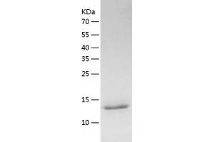 Western Blotting (WB) image for PDZ Domain Containing 11 (PDZD11) (AA 1-140) protein (His tag) (ABIN7124332) (PDZD11 Protein (AA 1-140) (His tag))