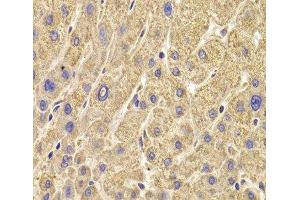 Immunohistochemistry of paraffin-embedded Human liver damage using PEX5 Polyclonal Antibody at dilution of 1:100 (40x lens). (PEX5 抗体)