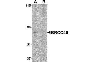 Western blot analysis of BRCC45 in HeLa cell lysate in (A) the absence and (B) presence of blocking peptide with AP30165PU-N BRCC45 antibody at 1 μg/ml.