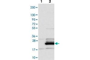 Western blot analysis of Lane 1: Negative control (vector only transfected HEK293T lysate). (FAM96B 抗体)