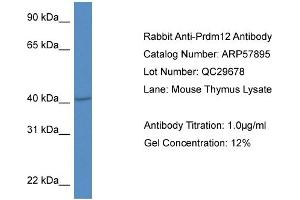 Western Blotting (WB) image for anti-PR Domain Containing 12 (PRDM12) (Middle Region) antibody (ABIN2787445) (PRDM12 抗体  (Middle Region))