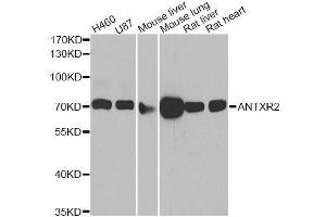 Western blot analysis of extracts of various cell lines, using ANTXR2 antibody. (ANTXR2 抗体  (AA 339-488))