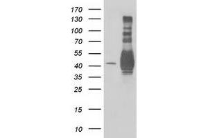 Western Blotting (WB) image for anti-Microtubule-Associated Protein, RP/EB Family, Member 2 (MAPRE2) antibody (ABIN1499321) (MAPRE2 抗体)