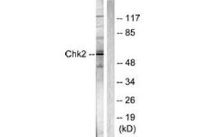 Western blot analysis of extracts from Jurkat cells, using Chk2 (Ab-387) Antibody. (CHEK2 抗体  (AA 361-410))