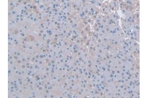 Detection of IFNg in Rat Adrenal gland Tissue using Polyclonal Antibody to Interferon Gamma (IFNg)
