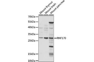 Western blot analysis of extracts of various cell lines, using RNF170 antibody (ABIN7270064) at 1:1000 dilution. (RNF170 抗体  (AA 46-120))