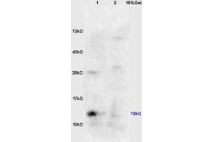 Lane 1: mouse kidney lysates Lane 2: mouse embryo lysates probed with Anti phospho-eIF4EBP1/4EBP1(Ser64) Polyclonal Antibody, Unconjugated (ABIN682963) at 1:200 in 4 °C. (eIF4EBP1 抗体  (pSer65))