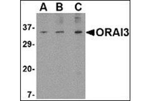 Western blot analysis of ORAI3 in A20 cell lysate with this product at (A) 1, (B) 2 and (C) 4 μg/ml. (ORAI3 抗体  (N-Term))