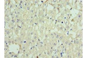 Immunohistochemistry of paraffin-embedded human liver tissue using ABIN7168634 at dilution of 1:100 (Sclerostin 抗体  (AA 24-213))