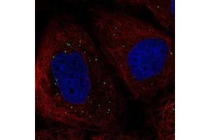Immunofluorescent staining of human cell line A-431 with KCNG1 polyclonal antibody  at 1-4 ug/mL dilution shows positivity in vesicles. (KCNG1 抗体)