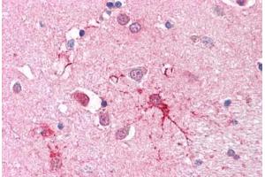 Human Brain, Basal Ganglia (SLC1A4 抗体  (C-Term))