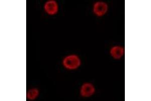 ABIN6275800 staining HepG2 by IF/ICC. (GATA6 抗体  (Internal Region))