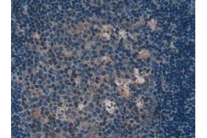 Detection of IL2Ra in Mouse Lymph node Tissue using Polyclonal Antibody to Interleukin 2 Receptor Alpha (IL2Ra) (CD25 抗体  (AA 22-235))