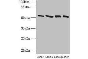Western blot All lanes: CCDC112 antibody at 12 μg/mL Lane 1: Jurkat whole cell lysate Lane 2: Hela whole cell lysate Lane 3: HepG2 whole cell lysate Lane 4: A549 whole cell lysate Secondary Goat polyclonal to rabbit IgG at 1/10000 dilution Predicted band size: 54, 62 kDa Observed band size: 54 kDa (CCDC112 抗体  (AA 201-446))