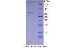 SDS-PAGE analysis of Mouse CARD9 Protein. (CARD9 蛋白)
