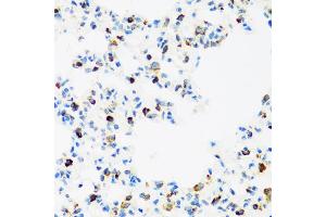 Immunohistochemistry of paraffin-embedded rat lung using FMRP antibody (ABIN6133703, ABIN6140719, ABIN6140721 and ABIN6221705) at dilution of 1:100 (40x lens). (FMR1 抗体  (AA 500-600))