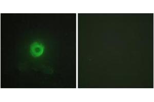 Immunofluorescence analysis of HeLa cells, using TNF Receptor II Antibody.