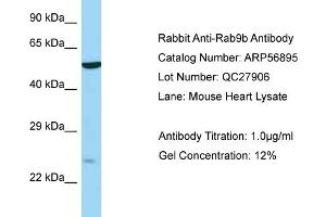 Western Blotting (WB) image for anti-RAB9B, Member RAS Oncogene Family (RAB9B) (N-Term) antibody (ABIN2786963) (RAB9B 抗体  (N-Term))