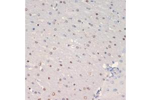 Immunohistochemistry of paraffin-embedded mouse brain using Olig2 antibody (ABIN6128396, ABIN6145015, ABIN6145016 and ABIN6216575) at dilution of 1:200 (40x lens). (OLIG2 抗体  (AA 1-80))