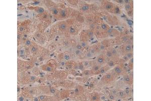 IHC-P analysis of liver tissue, with DAB staining. (ACADS 抗体  (AA 210-396))