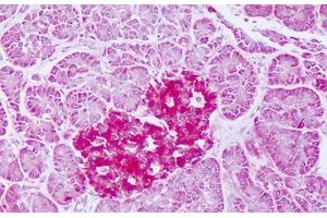 Image no. 1 for anti-Ferritin, Mitochondrial (FTMT) (AA 98-147) antibody (ABIN6749792) (Ferritin Mitochondrial 抗体  (AA 98-147))