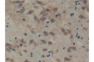 Detection of TXLNa in Mouse Cerebrum Tissue using Polyclonal Antibody to Taxilin Alpha (TXLNa) (alpha Taxilin 抗体  (AA 1-234))