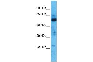 Host:  Rabbit  Target Name:  ZNF772  Sample Type:  Thymus Tumor lysates  Antibody Dilution:  1. (ZNF772 抗体  (N-Term))